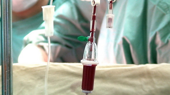 Blood Drip in Operation Room with Surgeons 