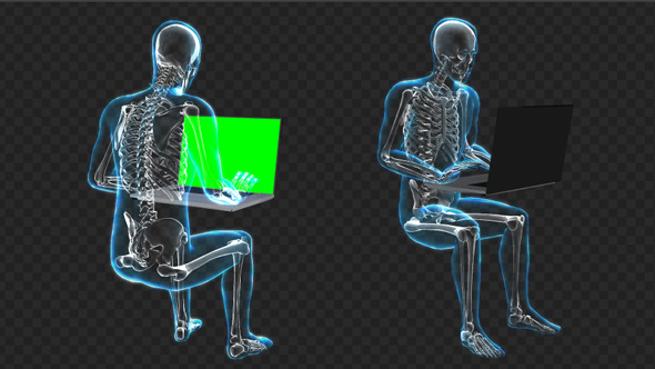 Man Working on a Computer in X-Ray