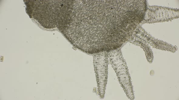 Colony of Infusorians of Trichodin Move and Move Along the Hydra and Near It, Under a Microscope alt