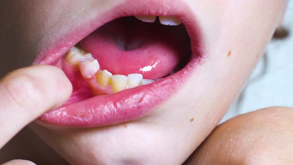 Macro of child trying to remove shaky baby tooth, Stock Footage | VideoHive