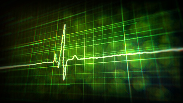 Heartbeat Monitor Backgrounds