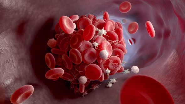 Formation of a Blood Clot, Motion Graphics | VideoHive