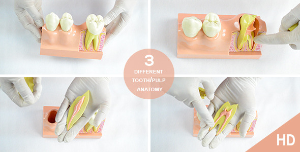 Dental Model: Tooth, Root and Pulp Anatomy alt