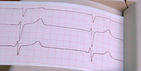Cardiogram Heart 3