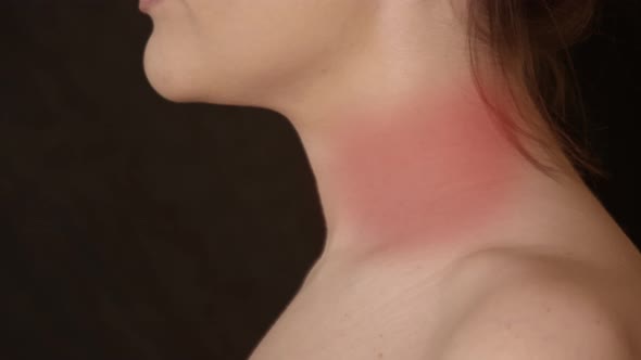 Young Woman Have a Pain in Neck and Throat. Shot with Graphic alt
