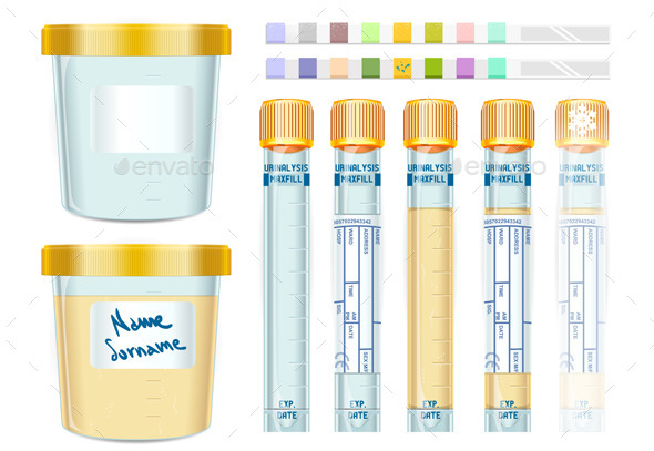 Urinalysis Yellow Cap Tubes Set - Objects Vectors