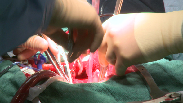 Close-Up Of Surgeon's Hands During Operation (8 Of 12)