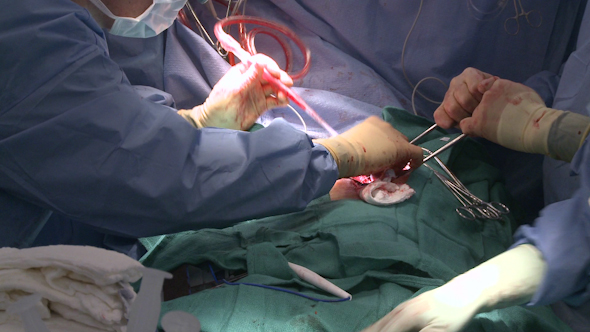 Surgeon Using Cell-Salvage And Electrocautery During Surgery (1 Of 4)