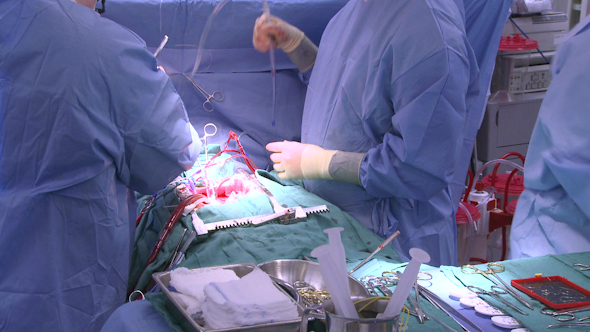 Surgeons Work Together On Heart Patient (5 Of 12)