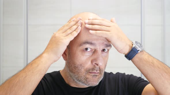 Bald Man Scared Of Losing Hair