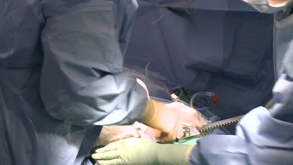 Surgeon Using Rib Retractor On Patient