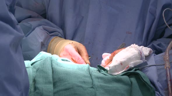 Closeup Of Surgeon's Hands