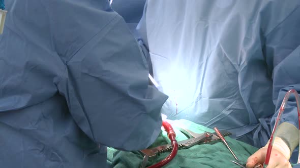 Surgeons Using Cell-Salvage On Heart Patient