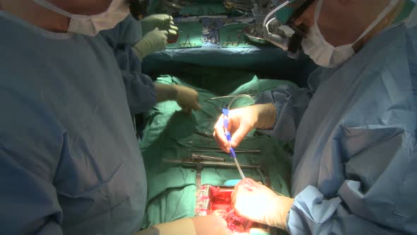 Pan Down On Surgeon Using Rib Retractor