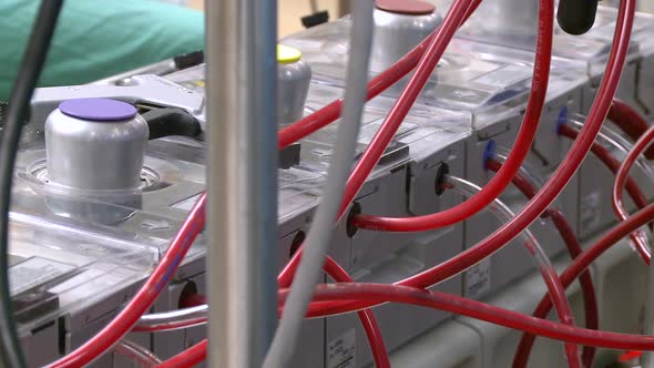 Tubes Carry Blood From A Bypass Machine (3 Of 8)