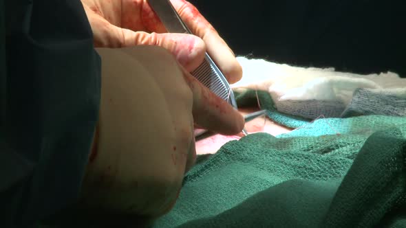 Surgeon Performs Final Stitches