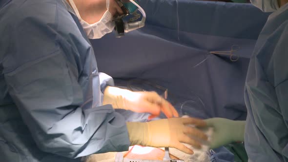 Surgeon Places Gauze Between Rib Retractors
