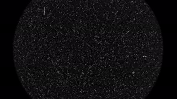 Colony of Bacteria Spirochetes alt