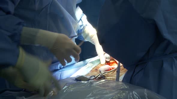 Spinal Surgery (15 Of 15)