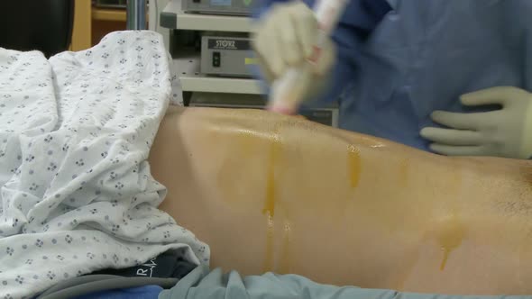 Patient's Abdomen Is Prepared For Surgery (1 Of 2)
