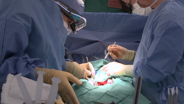 Surgeons Work Together On Heart Patient (1 Of 12)