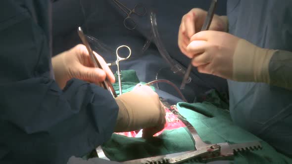 Surgeons Work Together On Heart Patient (9 Of 12)