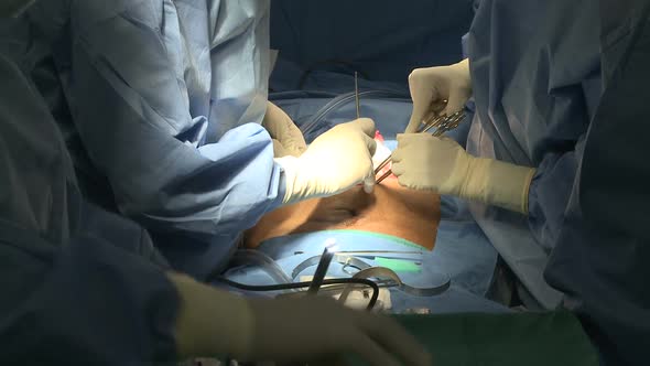 Hands At Work During Laparascopic Surgery (4 Of 10)