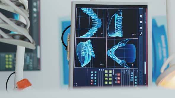 Vertical Video Close Up of Medical Stomatology Display with Teeth x Ray Images on It alt