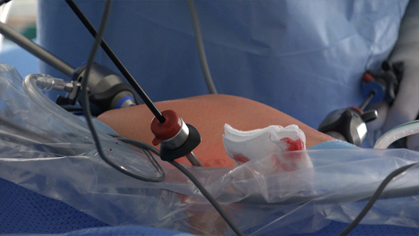  Gynaecology And Laparoscopy  alt