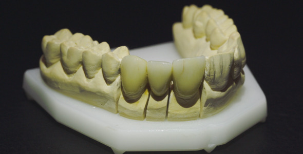 Overview Of Dentures