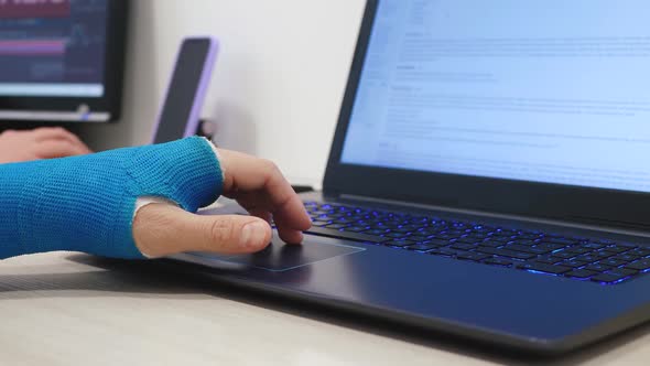 Fiberglass Cast Hand Uses Laptop