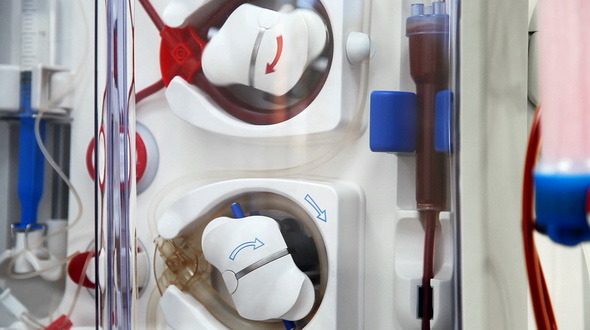 Dialysis Medical Device Performing Procedure