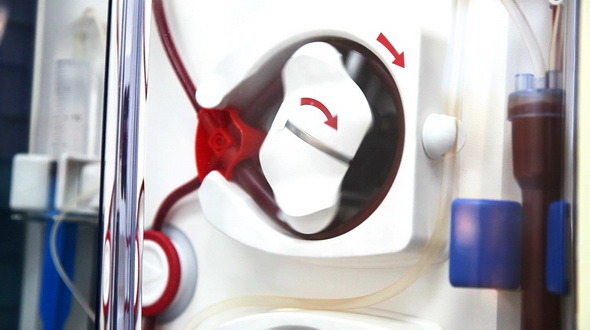 Rotating Pump of Dialysis Device alt