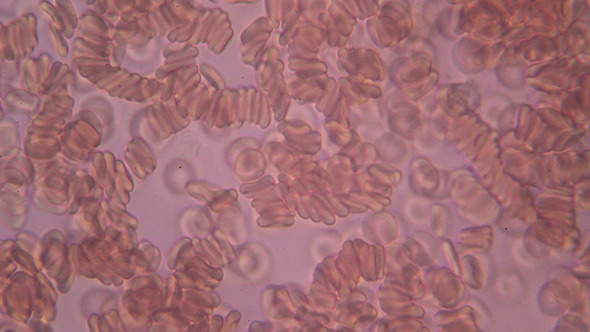 Microscopy: Human Blood 006