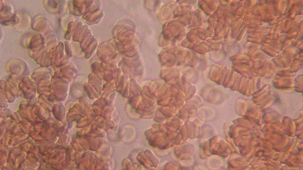 Microscopy: Human Blood 007