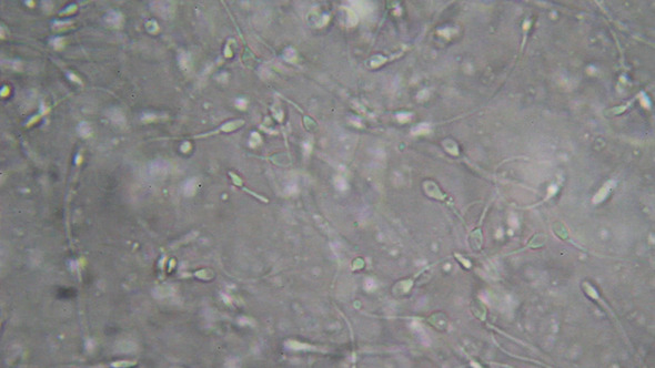 Microscopy: Live Human Sperm 001