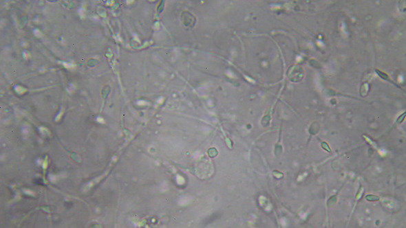 Microscopy: Live Human Sperm 002