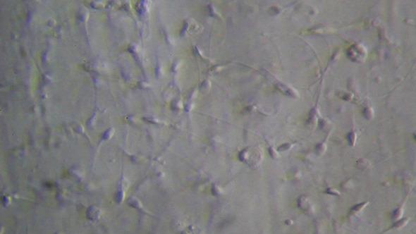 Microscopy: Live Human Sperm 003