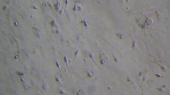 Microscopy: Live Human Sperm 004