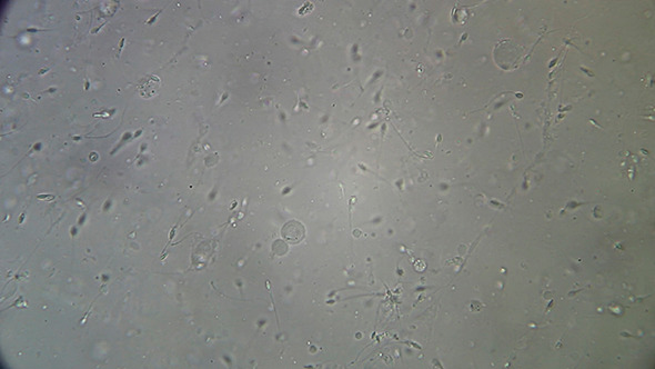 Microscopy: Live Human Sperm 005