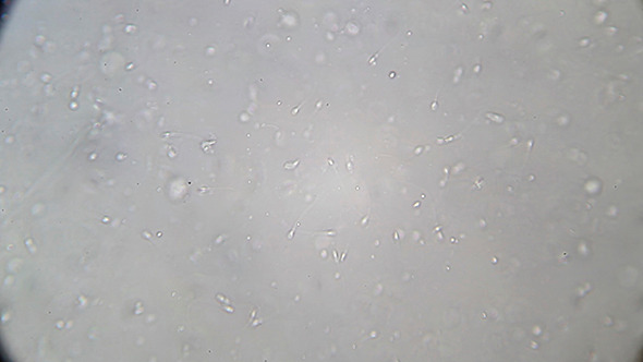 Microscopy: Live Human Sperm 006