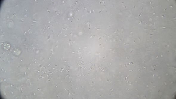 Microscopy: Live Human Sperm 007
