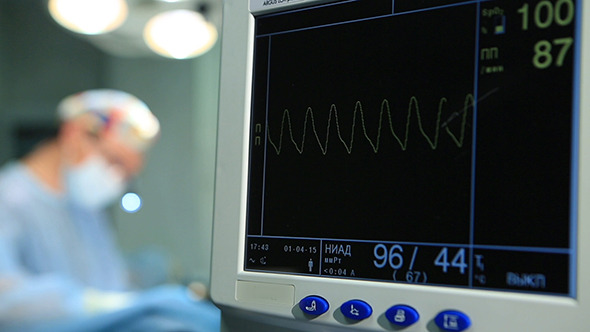 ElectroCardioGram Monitor alt