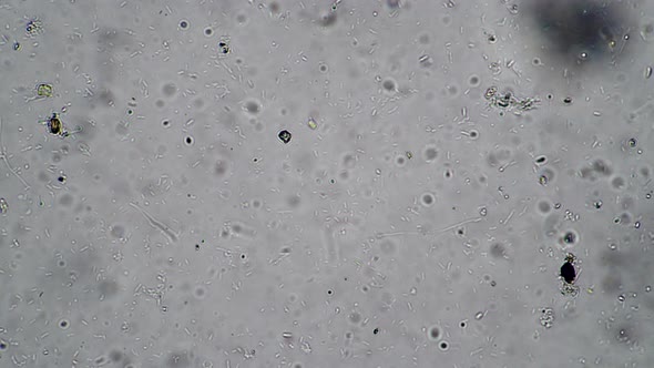 Microcosmic Background of the Bacteria of the Bacilli and a Variety of Protozoa alt