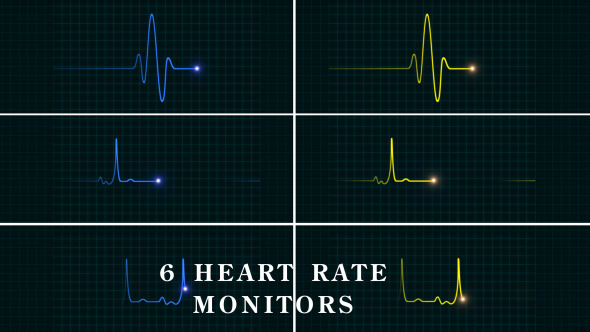 EKG Heartbeat Monitor, Motion Graphics | VideoHive