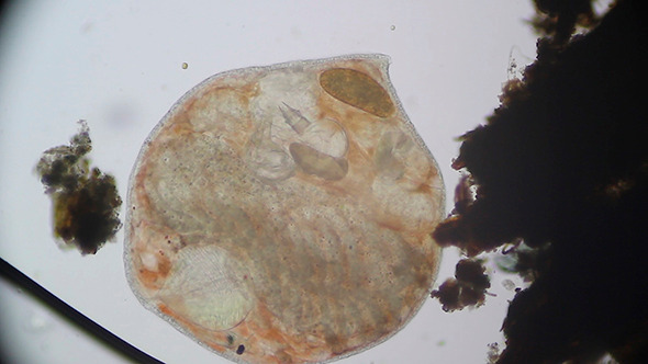 Microscopy: Worm Turbellaria (Dalyellia Viridis) 003