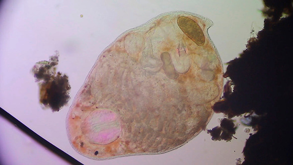 Microscopy: Worm Turbellaria (Dalyellia Viridis) 004