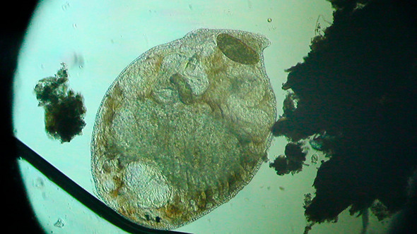 Microscopy: Worm Turbellaria (Dalyellia Viridis) 006