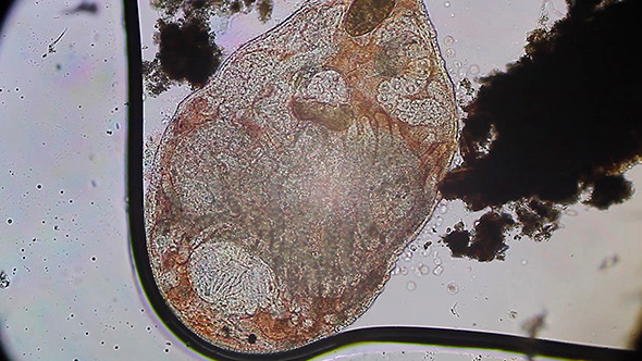 Microscopy: Worm Turbellaria (Dalyellia Viridis) 008