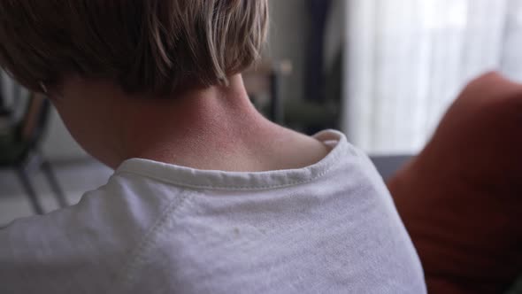 Symptoms of Photodermatitis alt